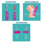 Diagram explaining adolescent apophyseal injury — showing how rapid bone growth outpaces tendon adaptation, creating vulnerability at growth plate attachment points in young athletes